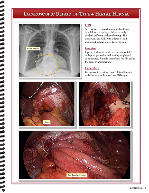 Cardiothoracic Surgeons' 
Case Studies Referral Booklet
