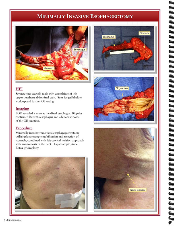 Cardiothoracic Surgeons' 
Case Studies Referral Booklet