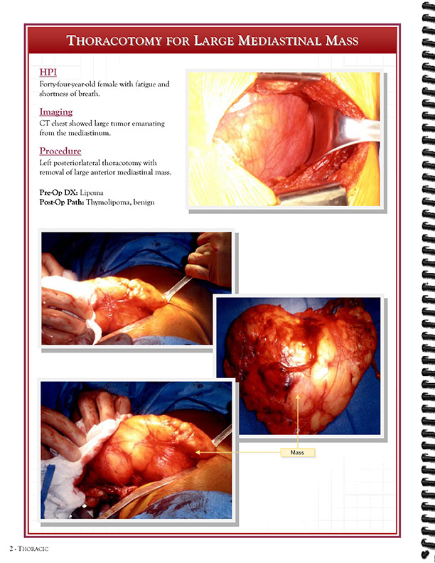 Cardiothoracic Surgeons' 
Case Studies Referral Booklet