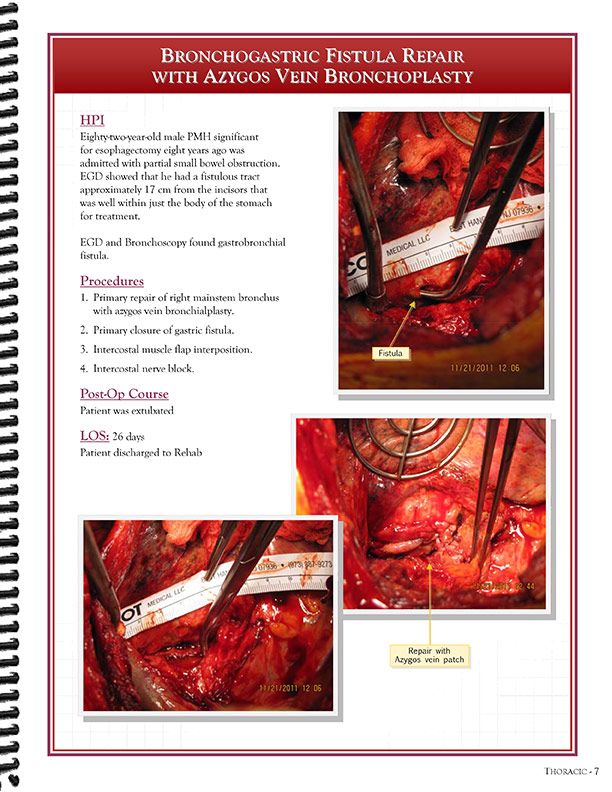 Cardiothoracic Surgeons' 
Case Studies Referral Booklet