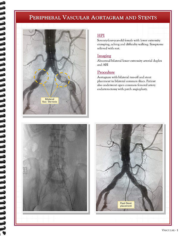 Cardiothoracic Surgeons' 
Case Studies Referral Booklet